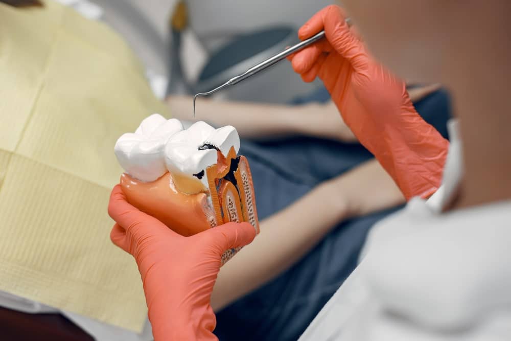 Quelles sont les causes de la carie dentaire ?