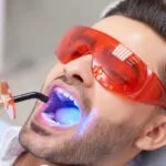 What are Teeth Whitening Methods?