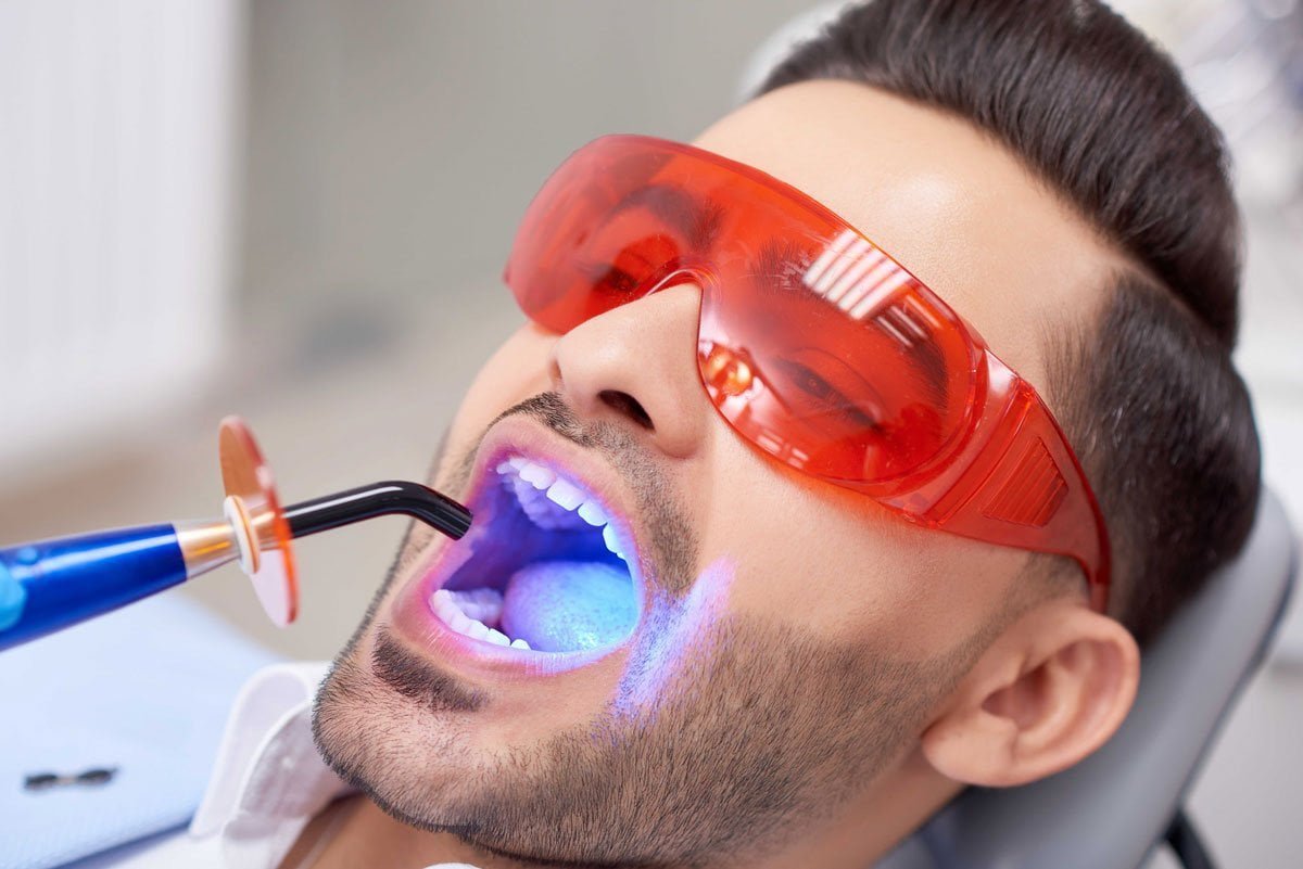 What are Teeth Whitening Methods?