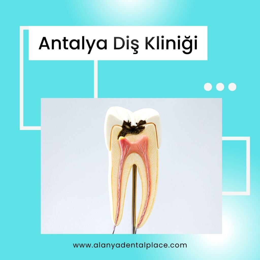 Antalya Diş Kliniği