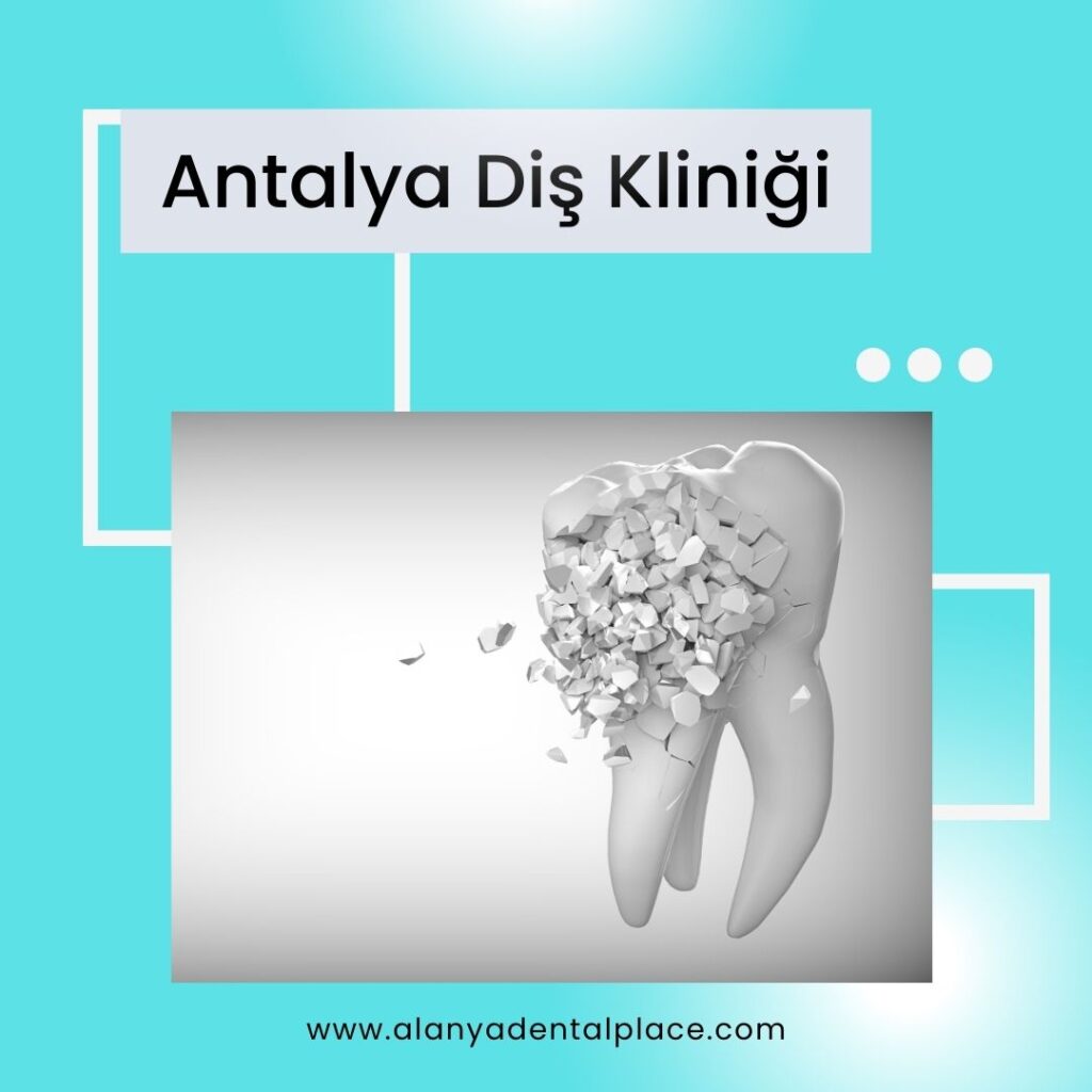 Antalya Diş Kliniği