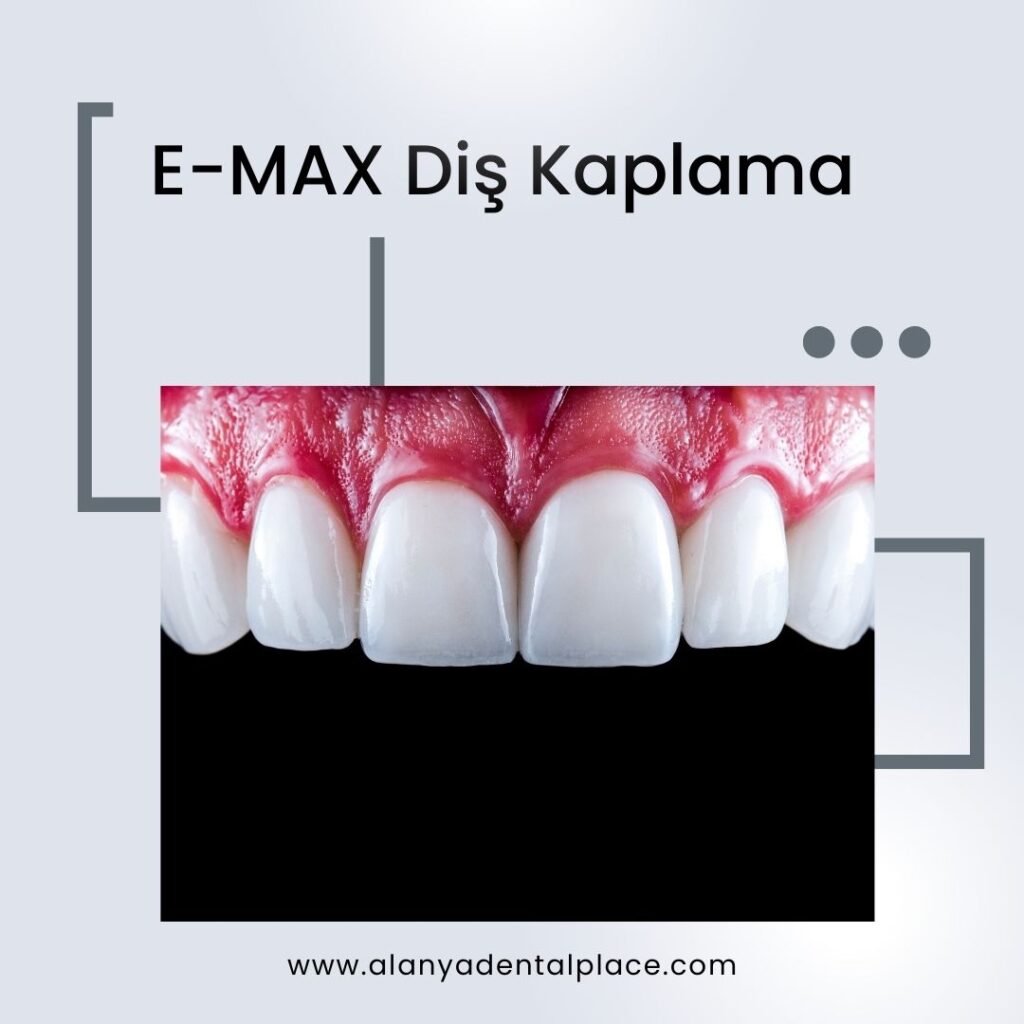 EMAX Dis Kaplama 3