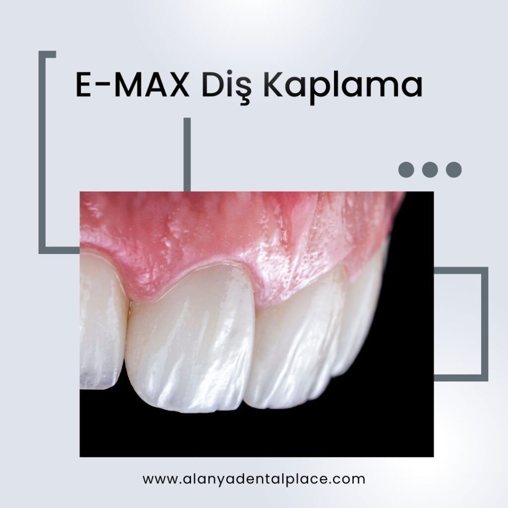 EMAX Dis Kaplama 5