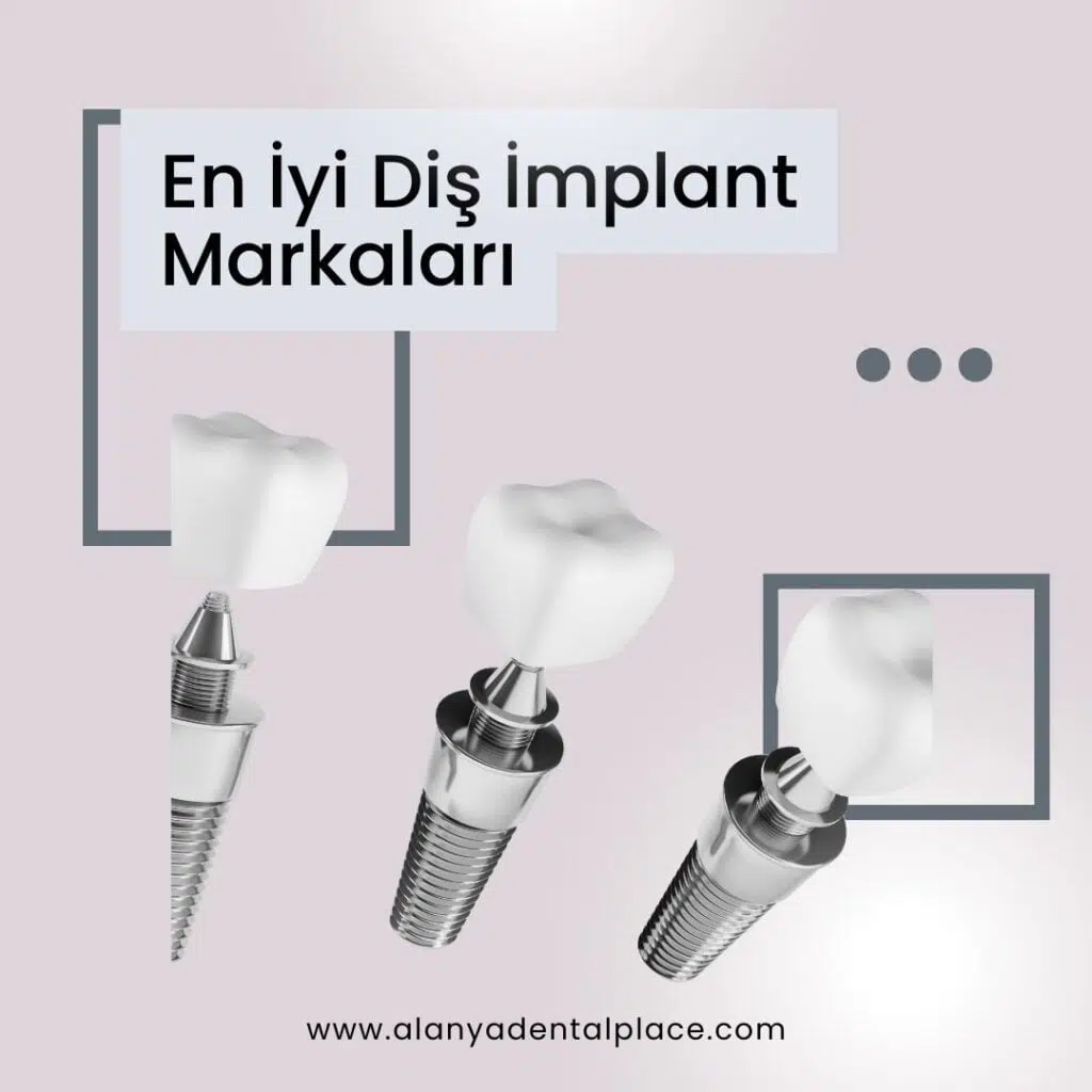 En Iyi Dis Implant Markalari