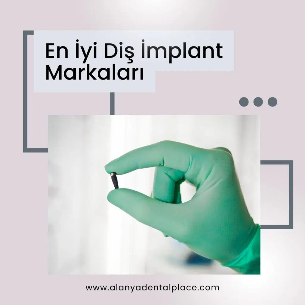 En Iyi Dis Implant Markalari 2