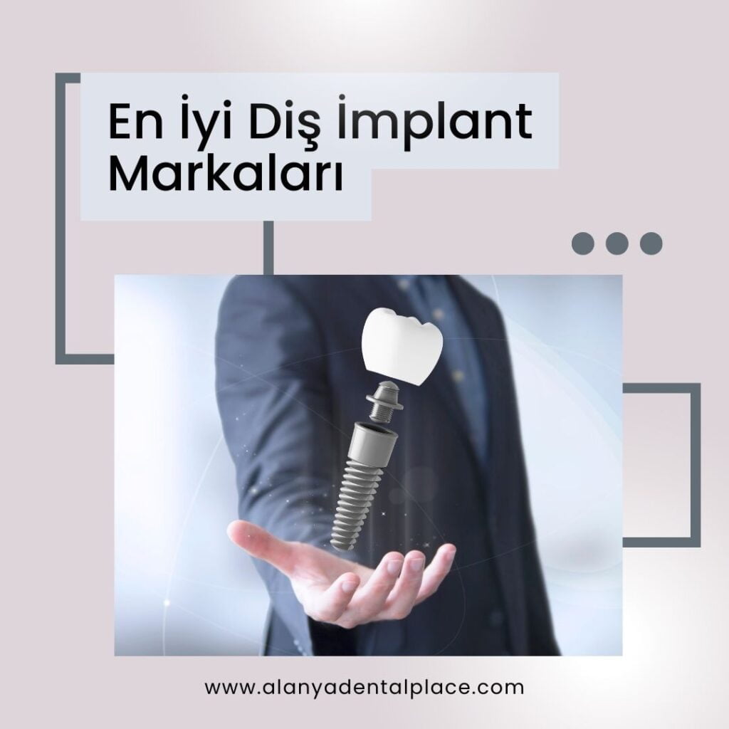 En Iyi Dis Implant Markalari 3