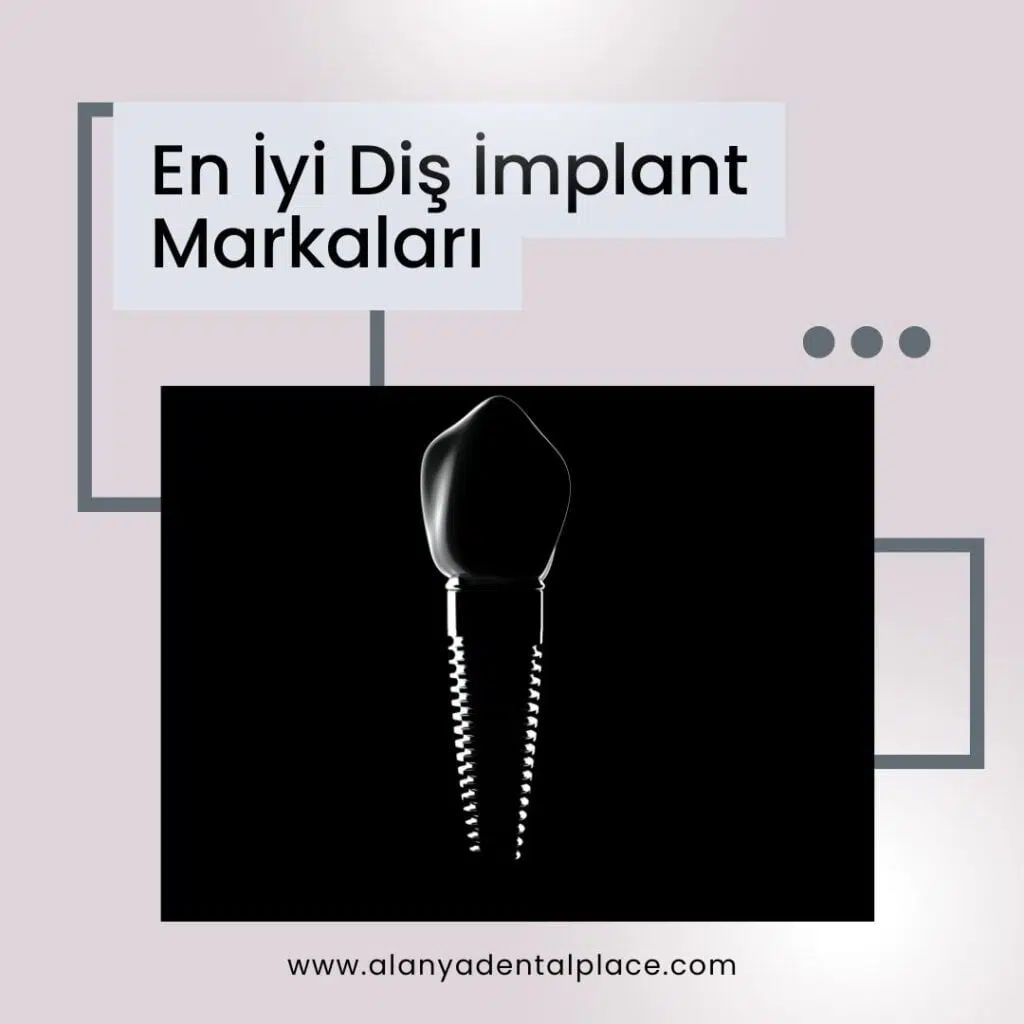 En Iyi Yabanci Dis Implant Markalari