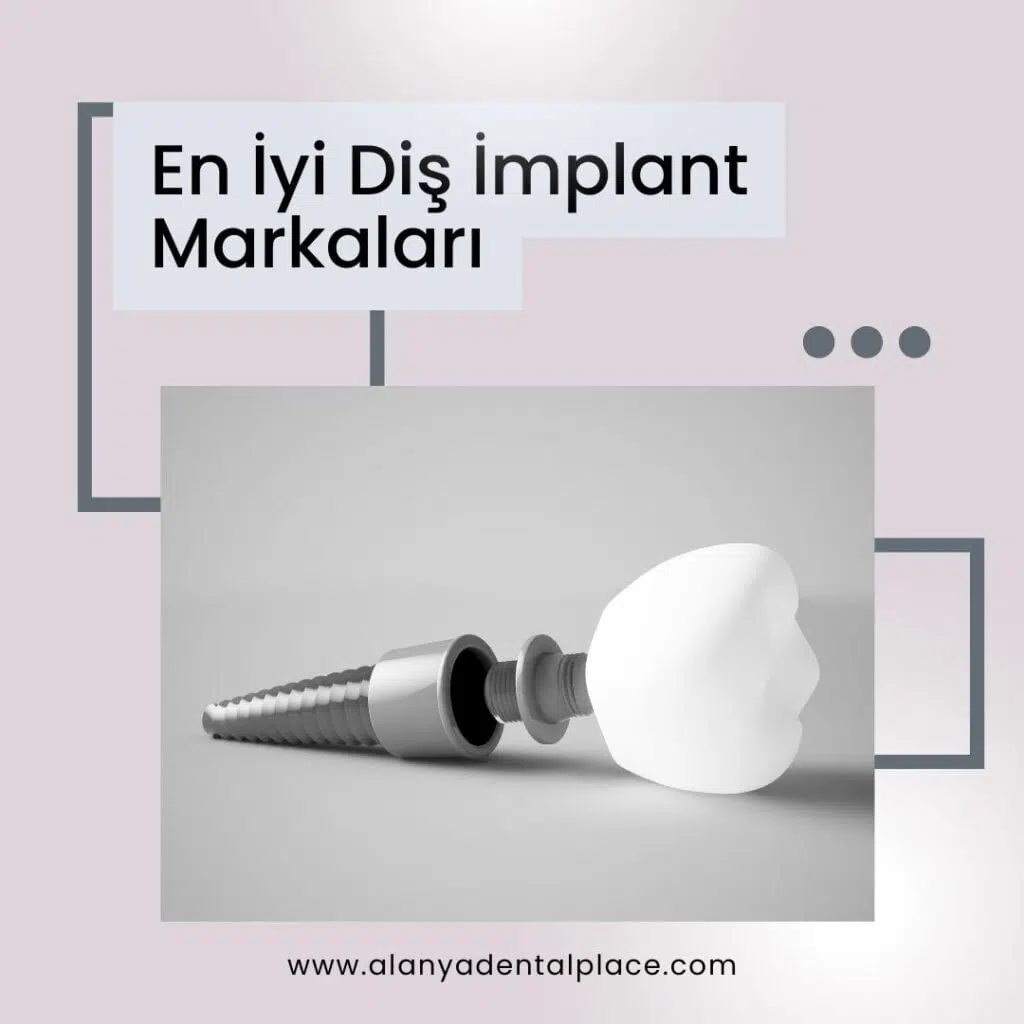En Iyi Yerli Dis Implant Markalari