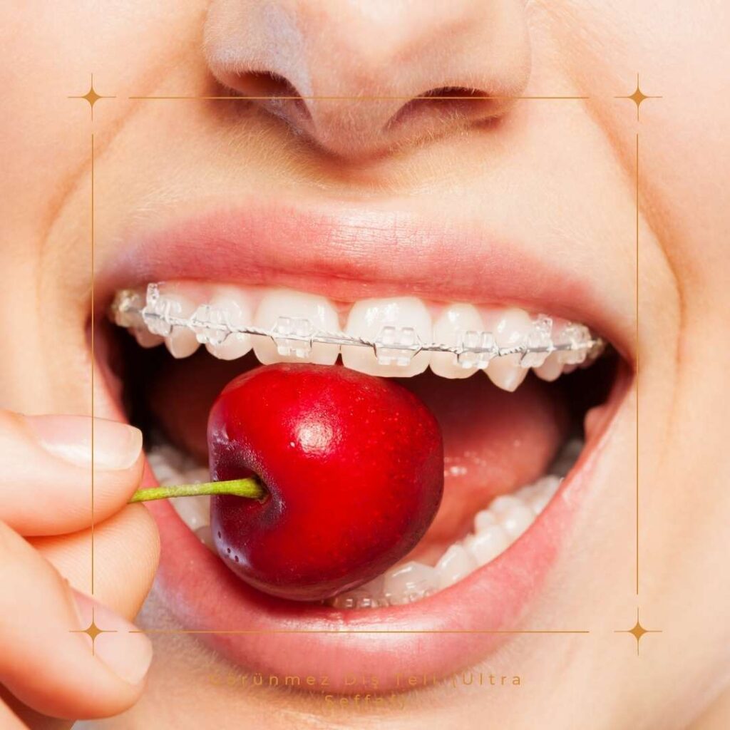 Diş Teli Tedavisi Neden Yapılır?