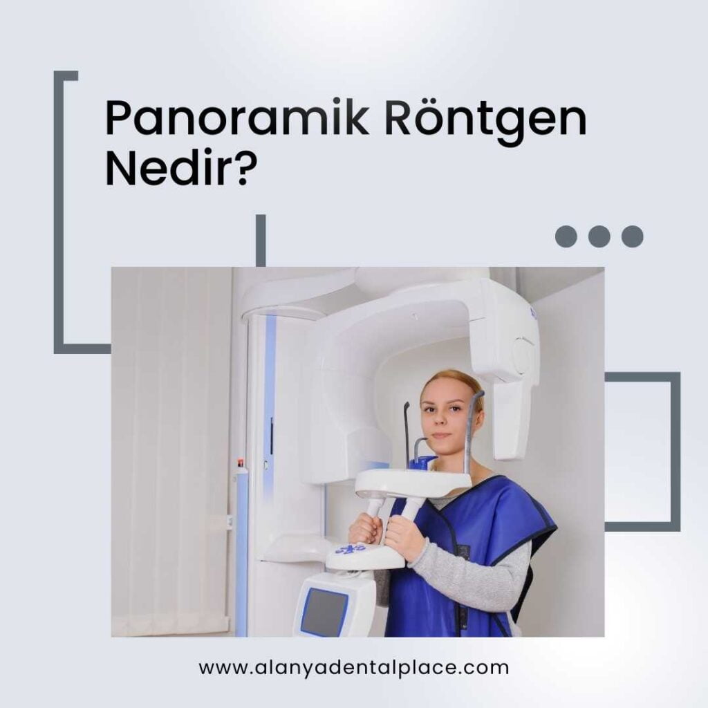Панорамный рентген