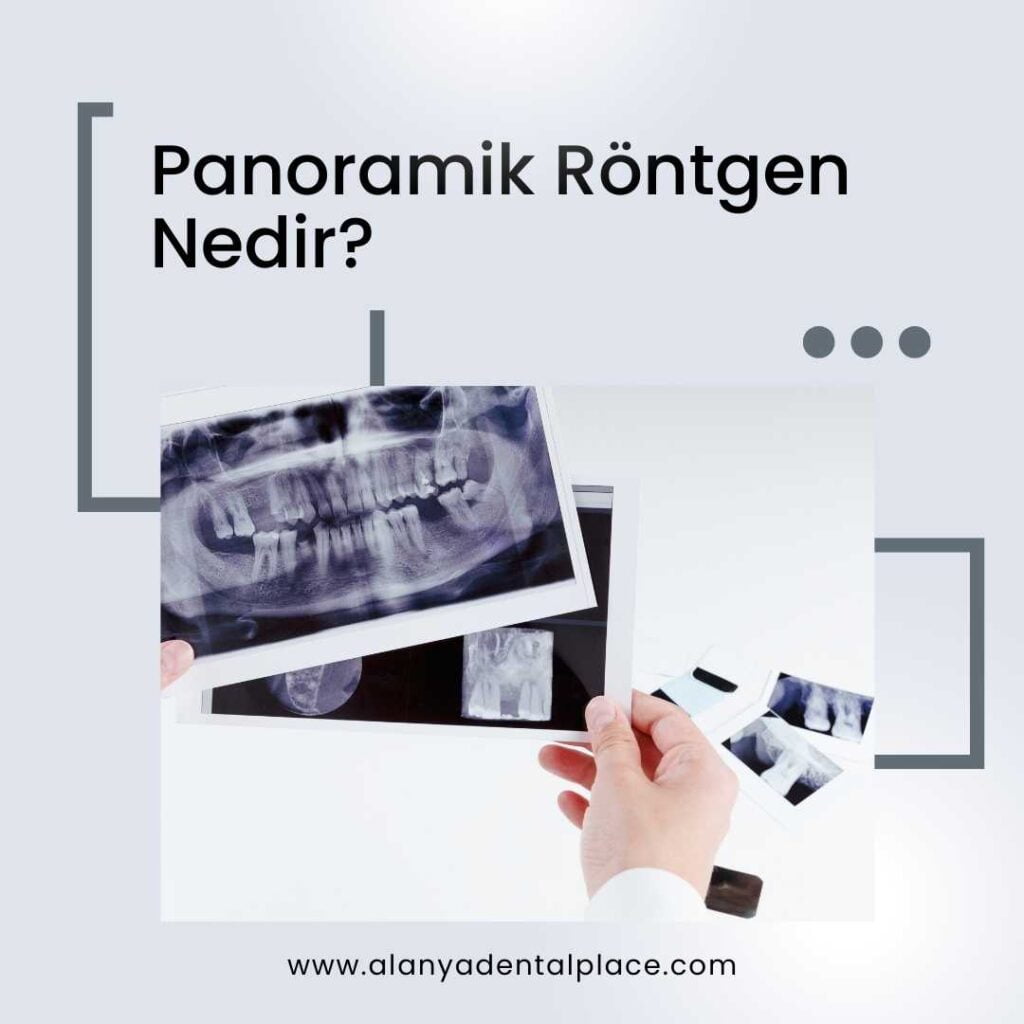 Panorama-Röntgenbild