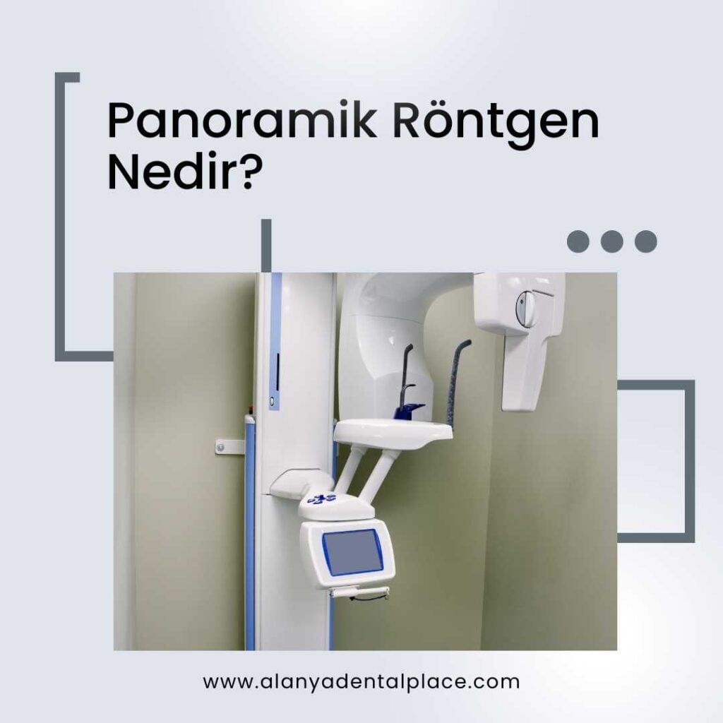 radiographie-panoramique