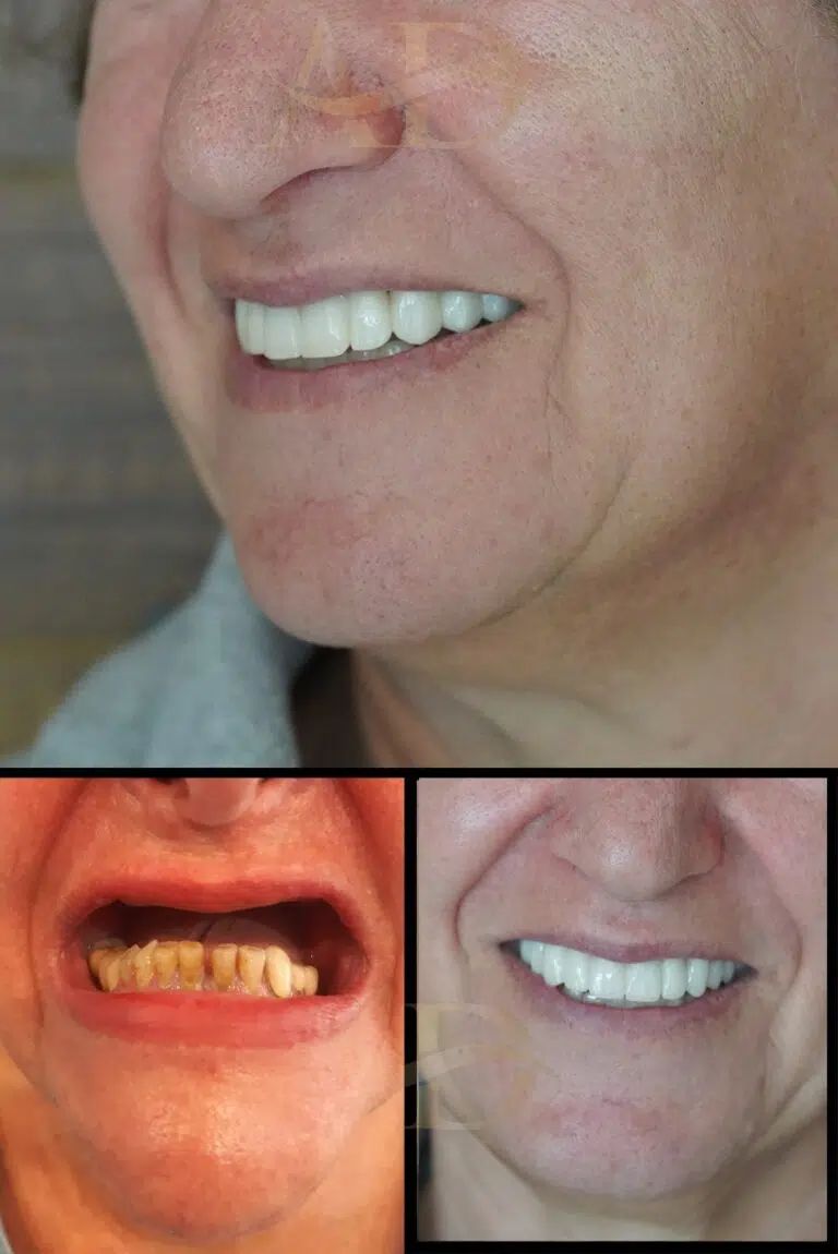 Dental Before After