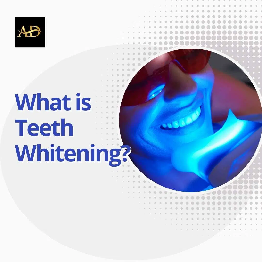  Alanya Teeth Whitening