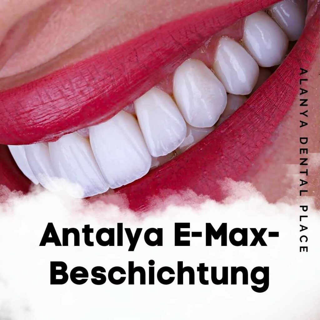 Antalya E-Max-Beschichtung