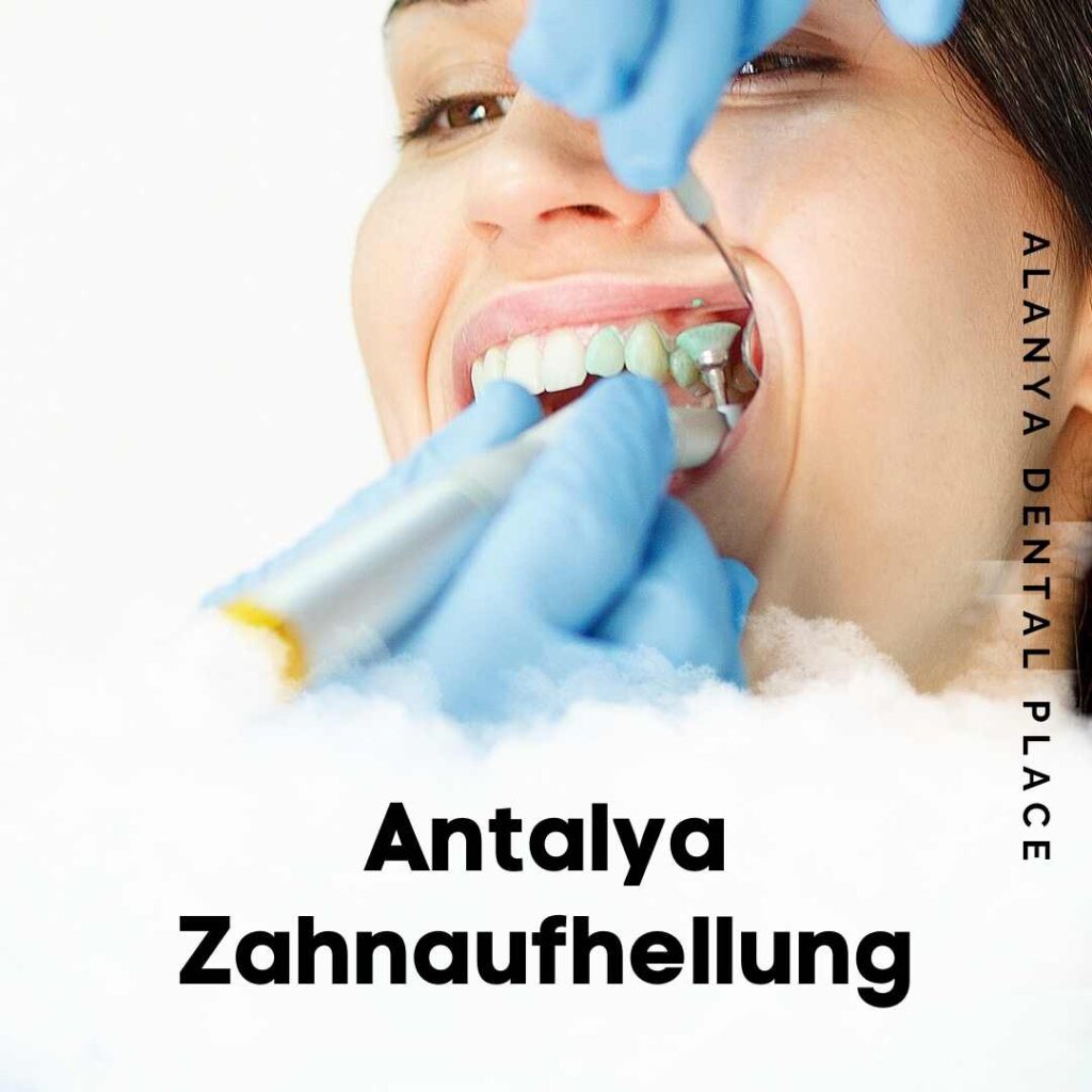 Antalya Zahnaufhellung