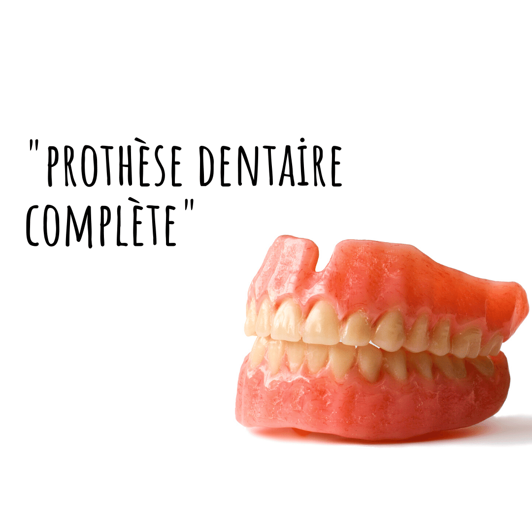 Qu'est-ce qu'une prothèse dentaire complète? - Alanya Dental Place