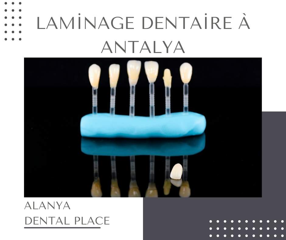 cliniques dentaires Antalya 6