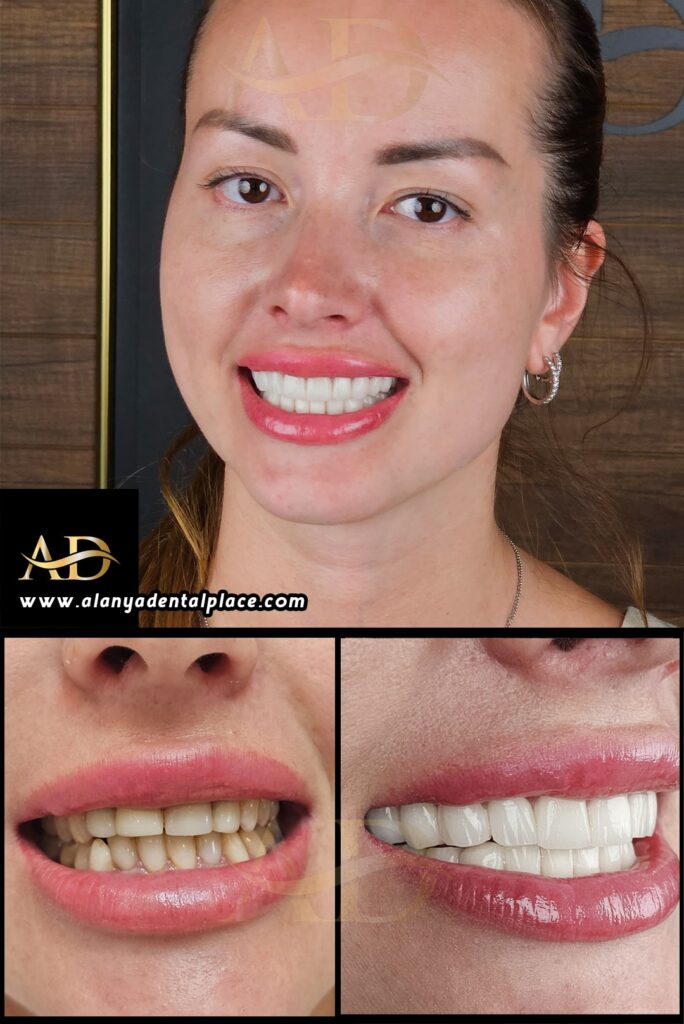 Dental Before After