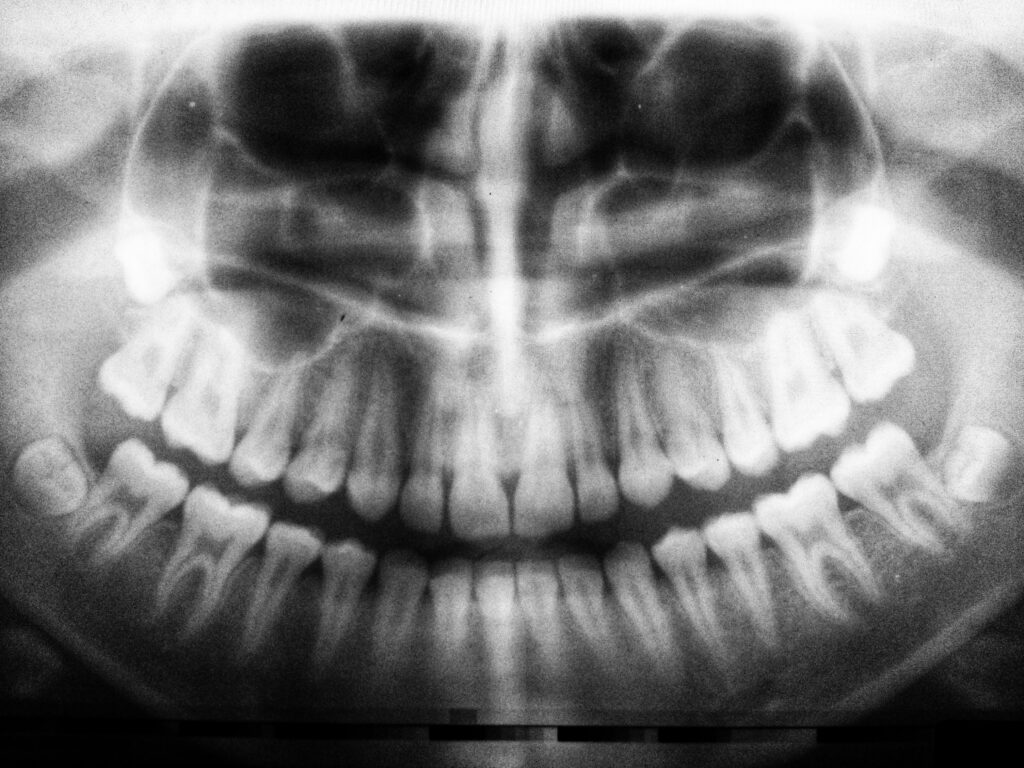 panoramic x-ray