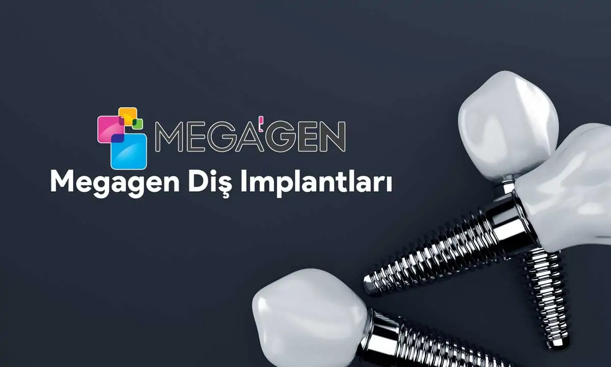 Megagen Implant Types and Prices