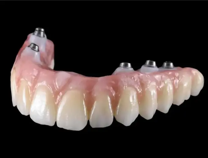 Fixed Zircon and Ceramic on Implant Turkey