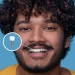 Implant in Full-Dentulous-Mouths