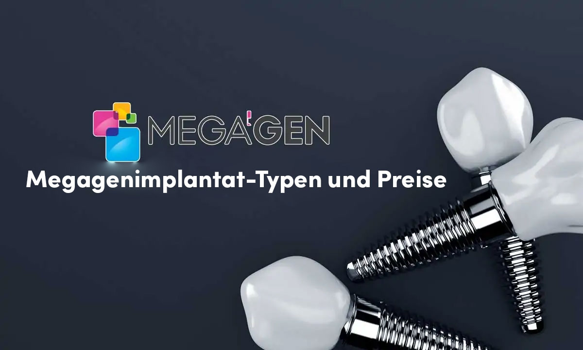 Megagenimplantat-Typen und Preise