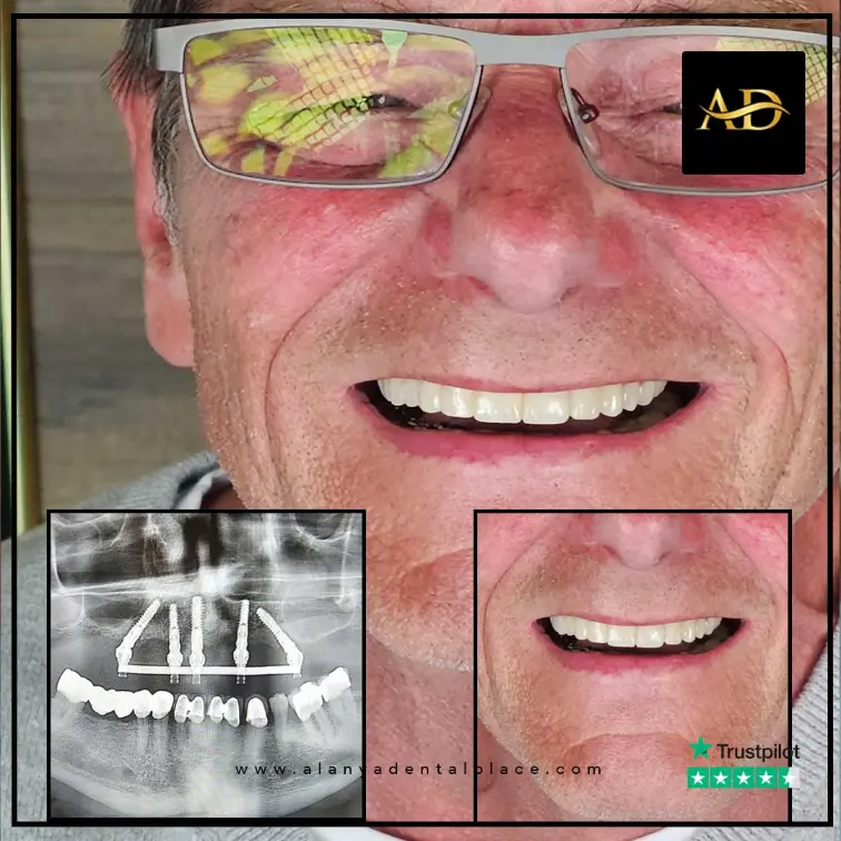 2-2-3.webp