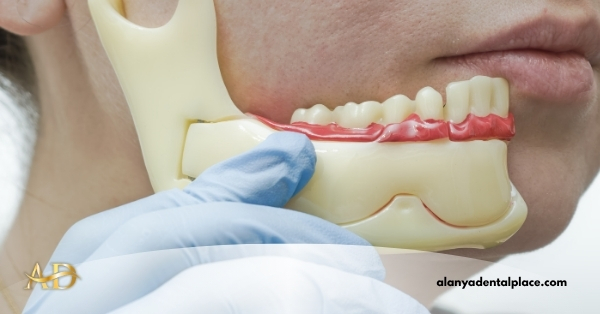 Bone Graft Surgery 3 Image link