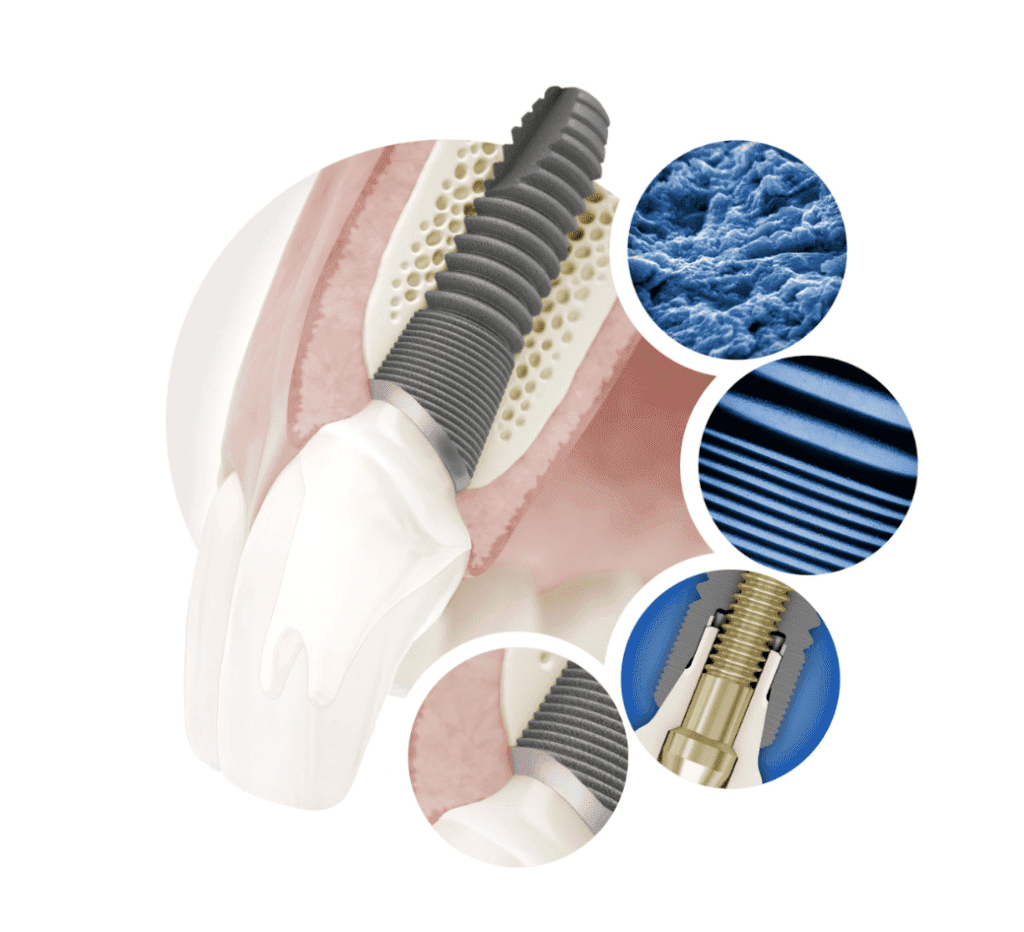 agresif implant türkiye