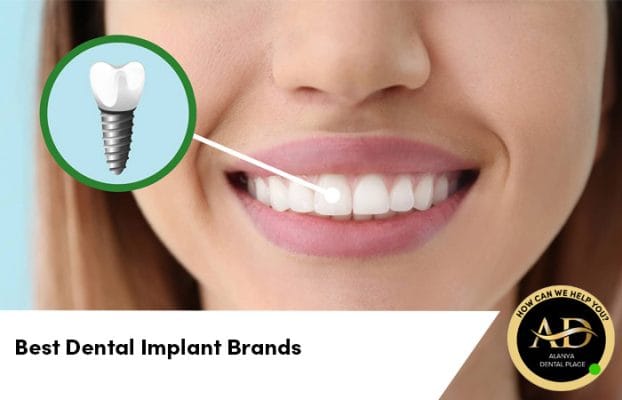 Best Dental Implant Brands