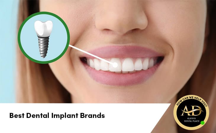 Best Dental Implant Brands