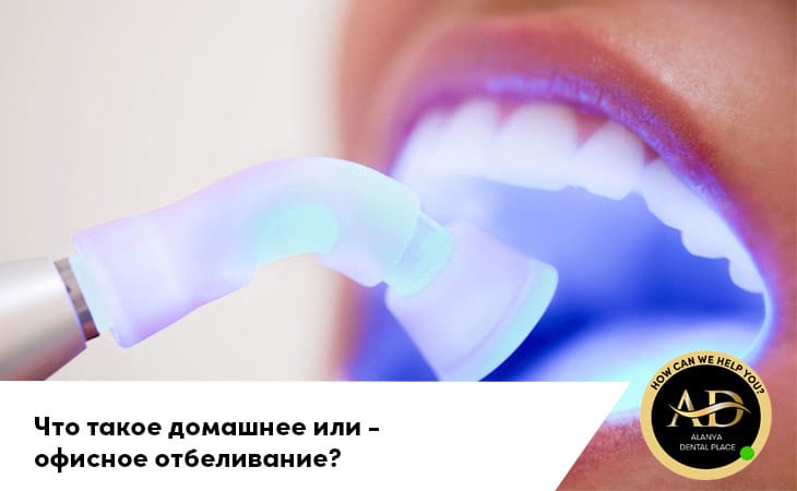 Что такое домашнее или офисное отбеливание?