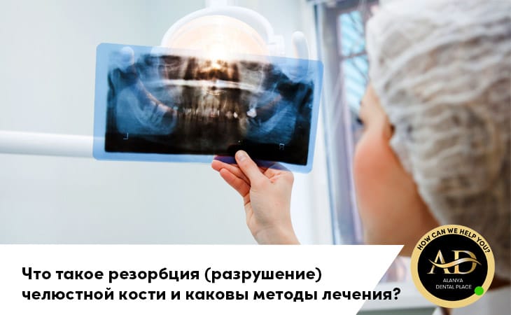 Что такое резорбция (разрушение) челюстной кости и каковы методы лечения?