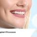 Dental Implant Processes