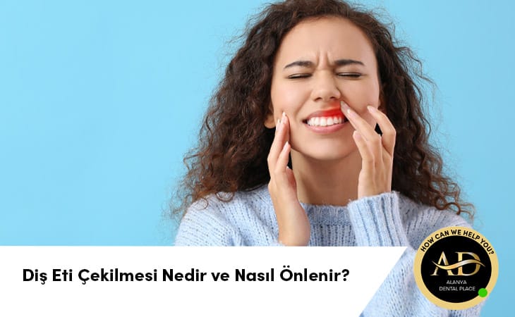 Diş Eti Çekilmesi Nedir ve Nasıl Önlenir?