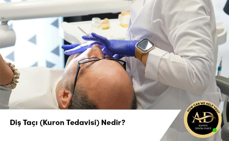Diş Tacı (Kuron Tedavisi) Nedir?