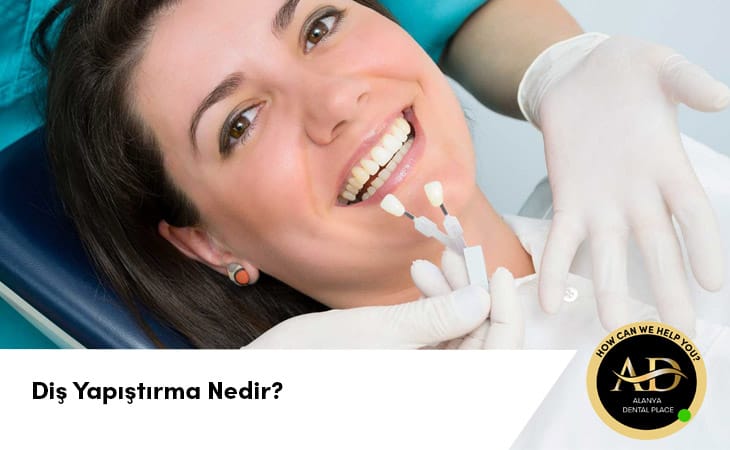 Diş Yapıştırma Nedir?