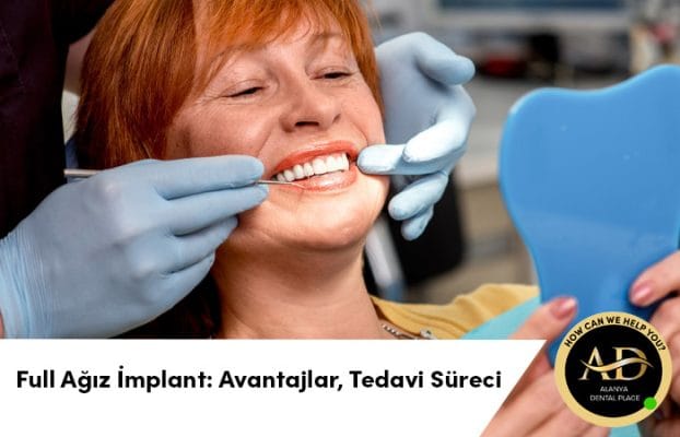 Full Ağız İmplant: Avantajlar, Tedavi Süreci