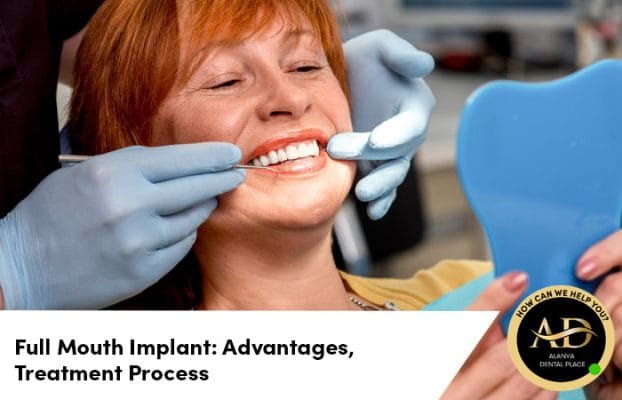 Full Mouth Implant: Advantages, Treatment Process