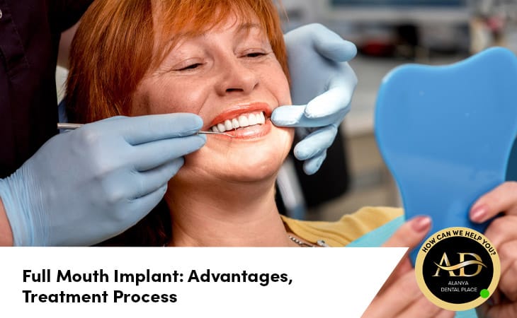 Full Mouth Implant: Advantages, Treatment Process