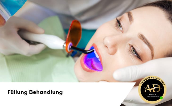 Füllung Behandlung