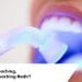 home bleaching ofis bleaching
