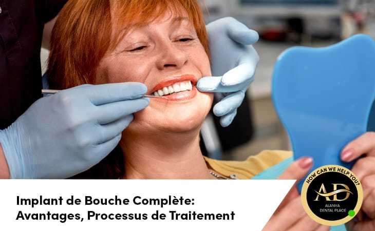 Implant de Bouche Complète: Avantages, Processus de Traitement