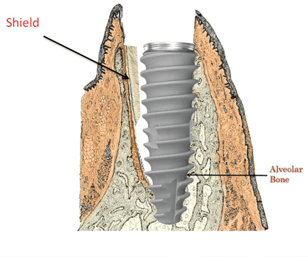 Image link