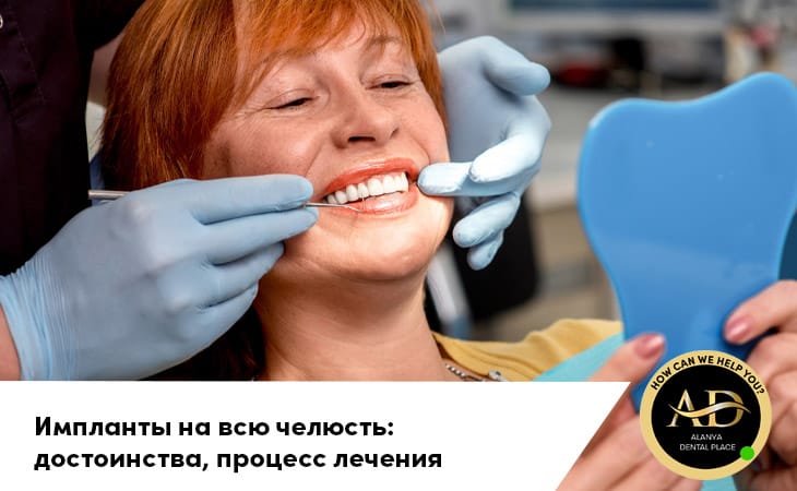 Импланты на всю челюсть: достоинства, процесс лечения