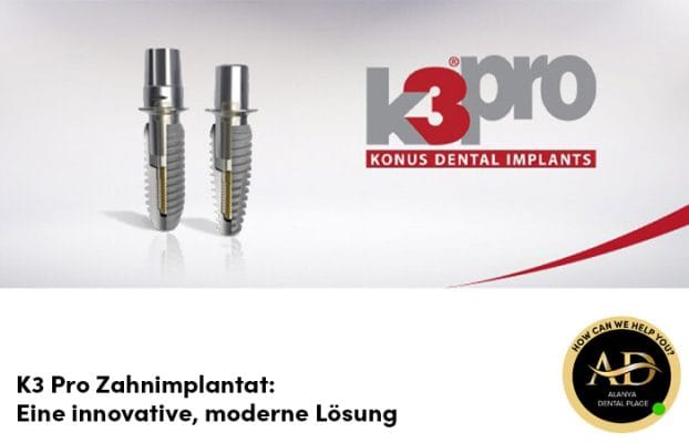 K3 Pro Zahnimplantat: Eine innovative, moderne Lösung