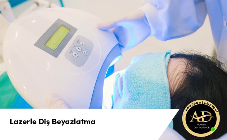 Lazerle Diş Beyazlatma