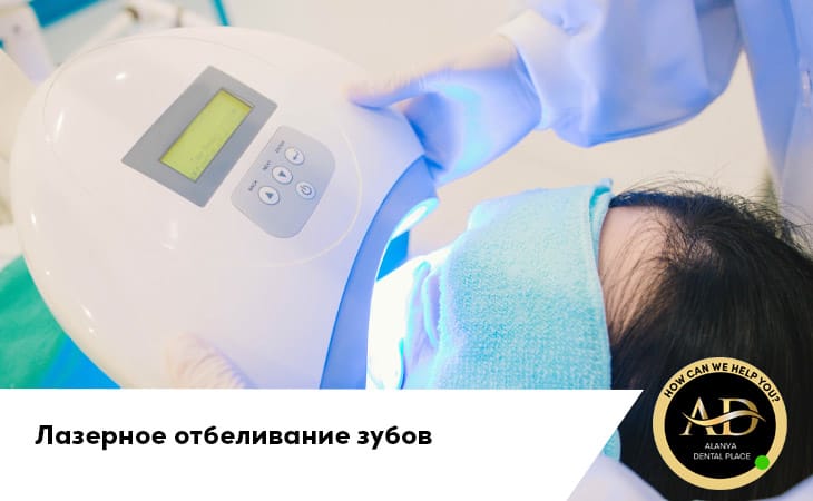 Лазерное отбеливание зубов